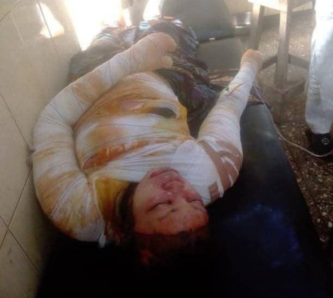 Woman Dies After Setting Self Ablaze In Bauchi